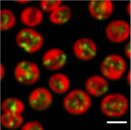 Fluorescence microscopy in Synechocystis cells.